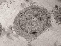 Cells without CD34