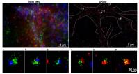 ATM and ATR Form Separate Synaptic Vesicle Patterns