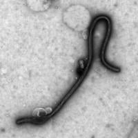 The ebolavirus-like particle generated to investigate the mechanisms of Ebola virus entry. 