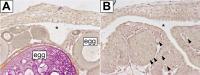 The feminizing effect is inherent to germ cells which are essential for the formation of ovaries. 