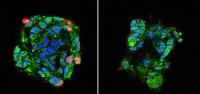 Human bronchial epithelial cells cultured with (right) or without (left) a calcium channel blocker (CCB) prior to exposure to IAV. Red signals show infected and replicated IAV. Treatment with CCB significantly suppressed IAV infections. 