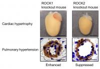 Opposing roles for two enzymes in heart failure