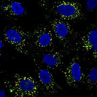 Dengue-infected cells taken under a microscope 
