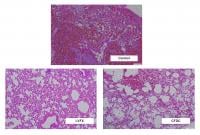 Hemorrhagic pneumonia