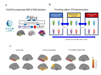 Traveling-subject (TS) harmonized brain imaging data shows reduced measurement bias