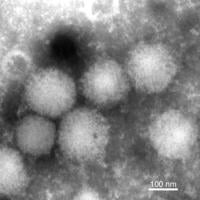 Transmission electron micrograph of the Yezo virus.