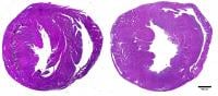 Cross-section of the heart