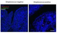 Detection of oral bacteria in gastric cancer tissue. 