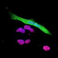 The expression of the immune response gene ​​NLRC5 (red purple) is suppressed in SARS-CoV-2 (green) infected cells (Photo: Ji-Seung Yoo, Koichi Kobayashi).