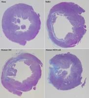 Treatment with human MITO cells (bottom right) effectively suppresses myocardial fibrosis in rat models with myocardial ischemia-reperfusion injury, compared to treatment with human CDCs (bottom left). Sham (top left) represents undamaged cardiac tissue, while Buffer (top right) represents damaged tissue without cell administration. (Masahiro Shiraishi, et al. Journal of Controlled Release. February 3, 2024)