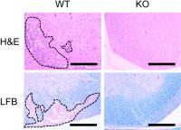 The inflammatory reaction in spinal cords of STAP-1 knockout (KO) mice was less severe than that of wild type (WT) mice (top panels). In parallel, spinal cords of STAP-1 KO mice exhibited less demyelination—loss of the myelin sheath that surrounds nerves—when compared with those of WT mice (bottom panels). (Kota Kagohashi, et al. The Journal of Immunology. February 5, 2024)