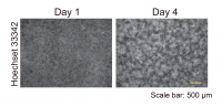 Keratinocytes display a self-organized pattern after four days in cultures. (Yosuke Mai, et al. Life Science Alliance. July 18, 2024)