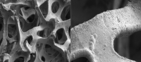 Scanning electron micrograph of the catalyst, NiOOH-Ni, developed in this study. (Hanwen Liu, et al. Advanced Energy Materials. August 7, 2024)