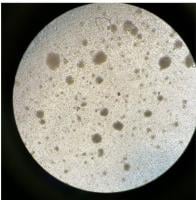 Clusters of T cells under a microscope