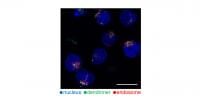 Dendrimers in T cells