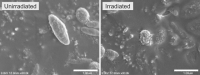 Scanning electron micrographs of melanosomes